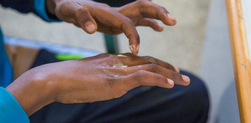 Leprosy, scabies and yaws - Togo's neglected tropical skin diseases need attention