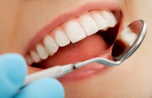 What Are The Benefits of Dental Insurance