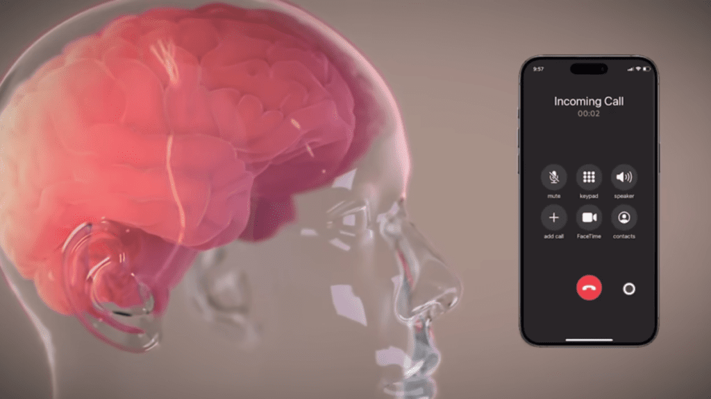 Elon Musk's Neuralink Cause For 'A Lot Of Concern': Doctors