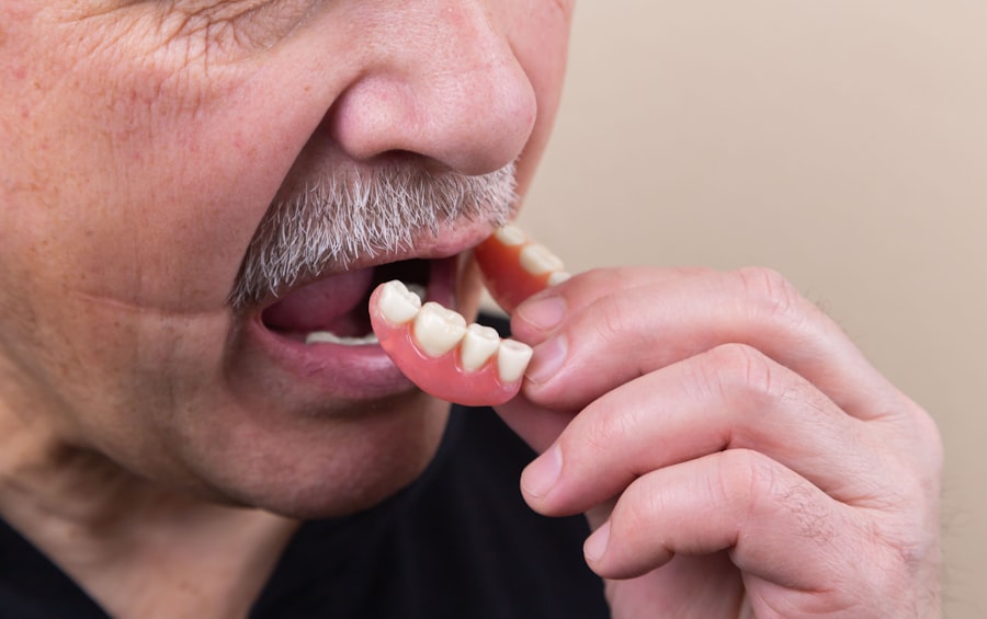 Understanding the Different Types of Dental Procedures Covered by Insurance 1 abcdhe 31